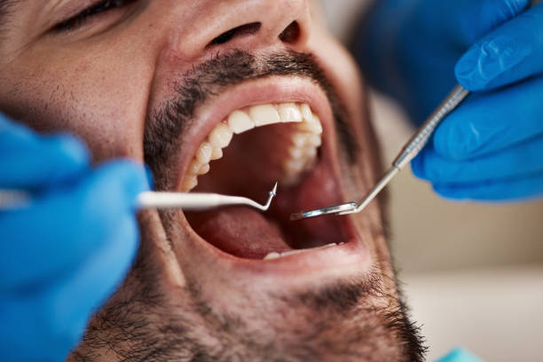 Dental Bonding in Carbondale, PA